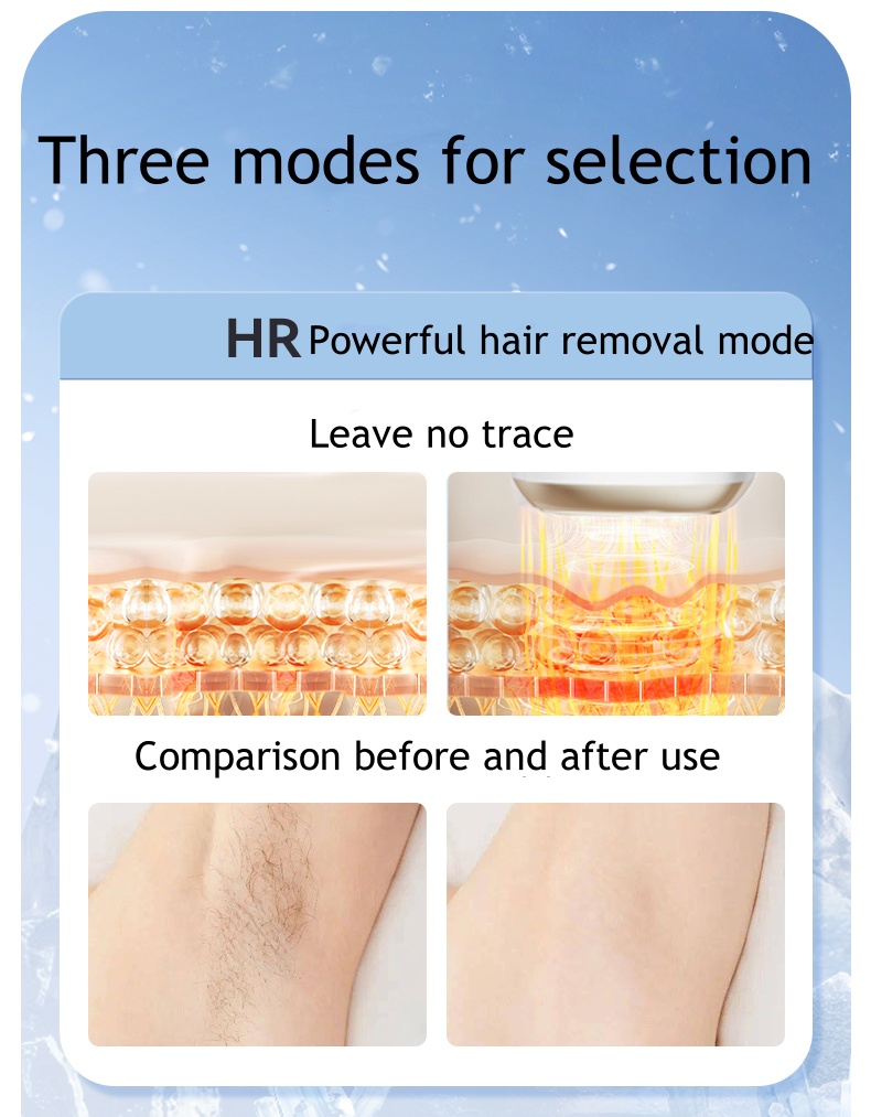 3-in-1 Replaceable Head Ice Hair Removal Device Full-Body Use for Lips Underarms and Private Area