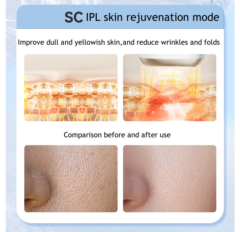 3-in-1 Replaceable Head Ice Hair Removal Device Full-Body Use for Lips Underarms and Private Area