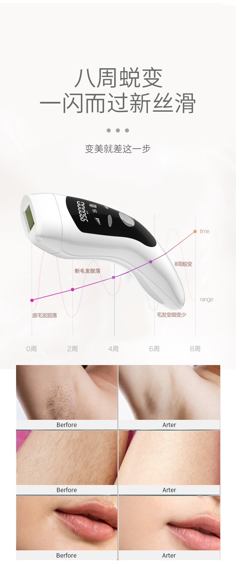 Best Portable IPL Hair Removal Device for Salon and Home Use Full-Body Painless Hair Removal