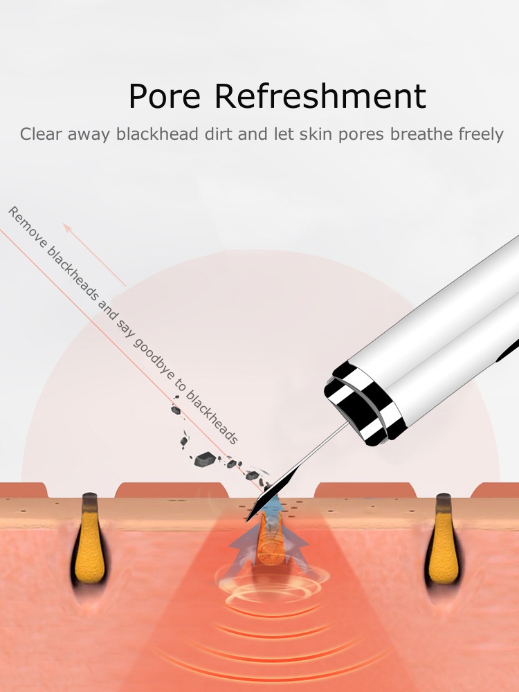 Ultrasonic Skin Scrubber with LCD Display - Exfoliating Dead Skin Remover & Facial Beauty Device